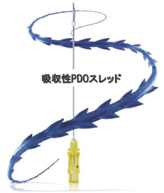 BARB2アンカー