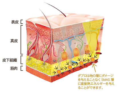 ダブロの効果とは？