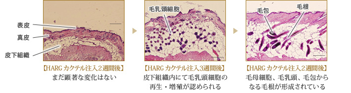 【頭皮にHARGカクテルを注入】頭皮の状態