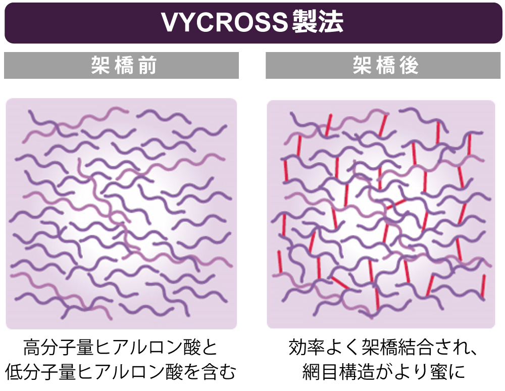 VYCROSS製法