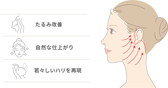 フェイスリフトとは