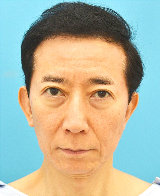 保志名院長の症例写真