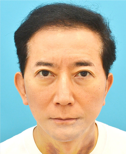保志名院長の症例写真