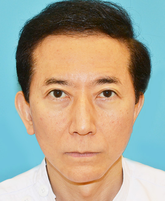 保志名院長の症例写真
