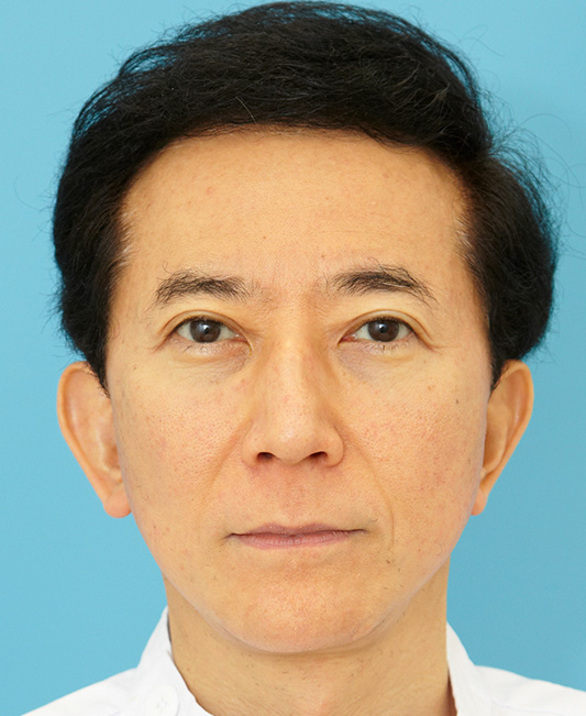 保志名院長の症例写真