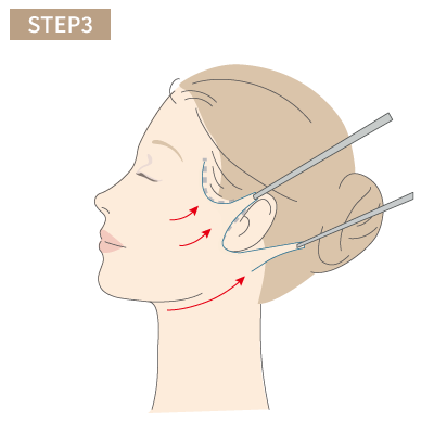 しっかりと皮膚を引き上げる