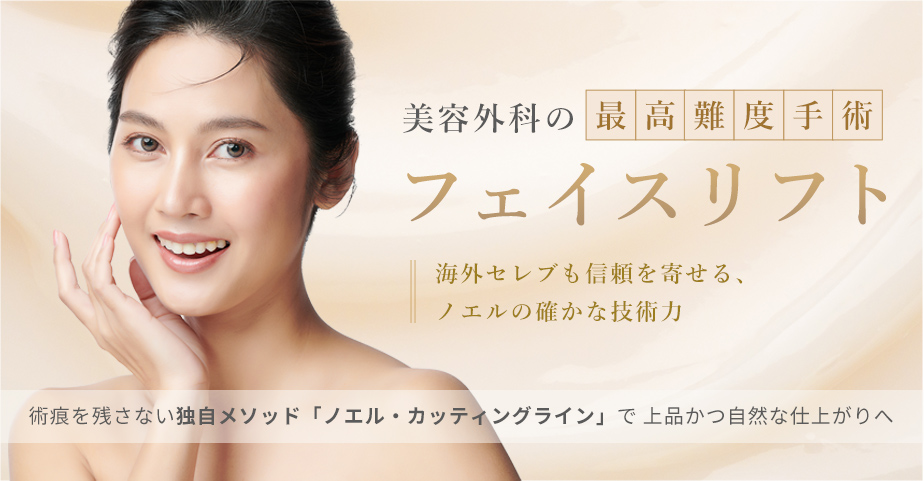 ノエル式フェイスリフト