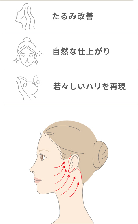 フェイスリフトとは