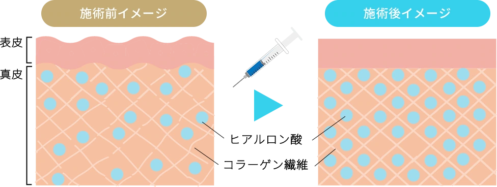 施術前後イメージ