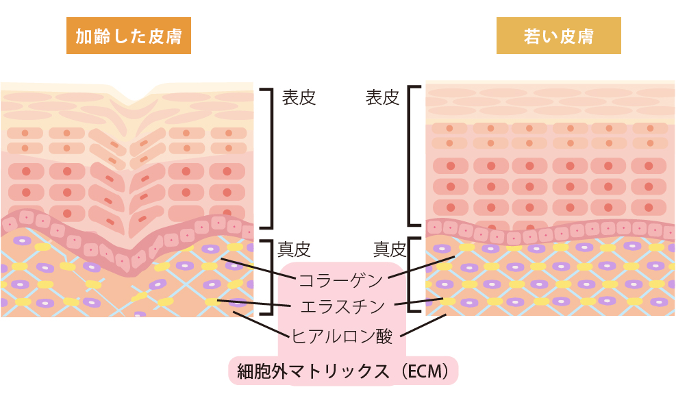 加齢した皮膚と若い皮膚の違い