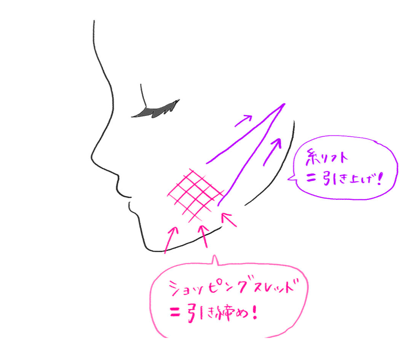 ショッピングスレッド