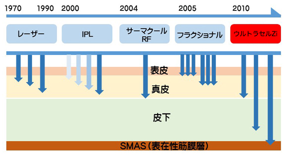 ウルトラセルZi（フェイス）