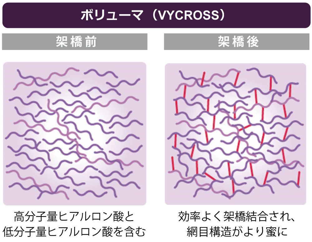 VYCROSS®の新技術